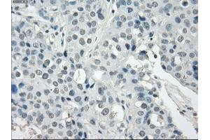 Image no. 1 for anti-Synovial Sarcoma, X Breakpoint 2 (SSX2) antibody (ABIN1501162) (SSX2 anticorps)