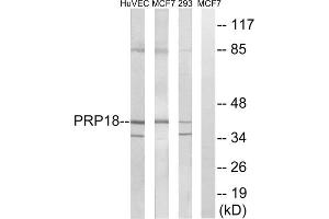 Western blot analysis of extracts from HuvEc cells, MCF-7 cells and 293 cells, using PRPF18 antibody. (PRPF18 anticorps  (Internal Region))