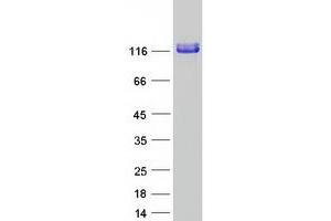 Validation with Western Blot