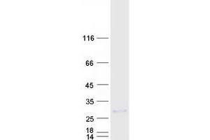 Validation with Western Blot