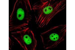 Confocal immunofluorescent analysis of EZH2 antibody and human HeLa cells followed by Alexa Fluor 488-conjugated goat anti-rabbit lgG (green).
