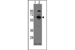Image no. 1 for anti-Poly (ADP-Ribose) Polymerase Family, Member 6 (PARP6) (C-Term) antibody (ABIN358805) (PARP6 anticorps  (C-Term))
