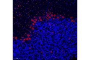 Immunofluorescence of paraffin embedded rat cerebellum using NOVA2 (ABIN7074810) at dilution of 1: 200 (200x lens) (NOVA2 anticorps)