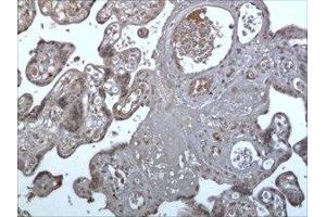 Immunohistochemistry (IHC) image for anti-Triggering Receptor Expressed On Myeloid Cells 1 (TREM1) (AA 21-205) antibody (ABIN1983467) (TREM1 anticorps  (AA 21-205))
