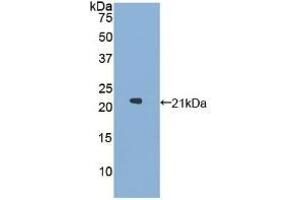 Detection of Recombinant GaA, Human using Polyclonal Antibody to Glucosidase Alpha, Acid (GaA) (GAA anticorps  (AA 595-770))