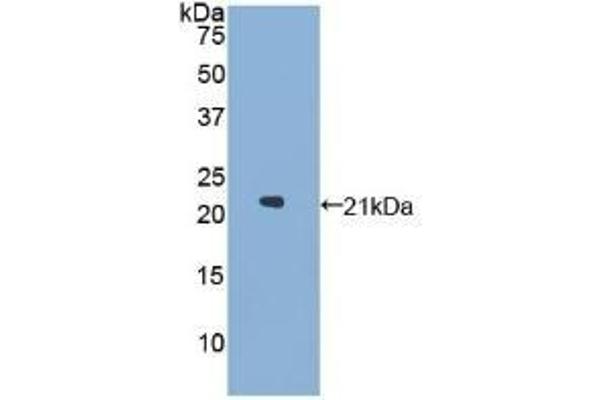 GAA anticorps  (AA 595-770)
