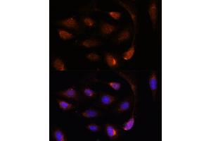 Immunofluorescence analysis of U-2 OS cells using SH3BGRL antibody (ABIN7270277) at dilution of 1:100.