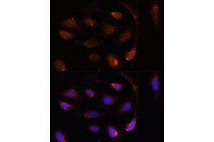 Immunofluorescence analysis of U-2 OS cells using SH3BGRL antibody (ABIN7270277) at dilution of 1:100. (SH3BGRL anticorps  (AA 1-114))