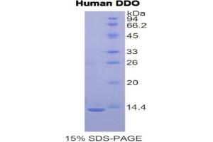 SDS-PAGE of Protein Standard from the Kit (Highly purified E. (DDO Kit ELISA)