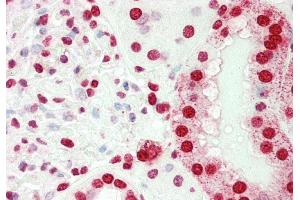 Rabbit Anti-SMARCE1 antibody Catalog Number: ARP33313 Formalin Fixed Paraffin Embedded Tissue: Human Kidney Primary antibody Concentration: 1:100 Secondary Antibody: Donkey anti-Rabbit-Cy3 Secondary Antibody Concentration: 1:200 Magnification: 20x Exposure Time: 0.