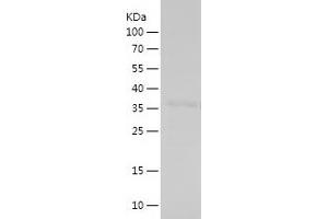 Western Blotting (WB) image for Histone Cluster 1, H1c (HIST1H1C) (AA 28-130) protein (His-IF2DI Tag) (ABIN7123341)