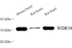 Western blot analysis of WDR38 (ABIN7076218) at dilution of 1: 2000 (WDR38 anticorps)
