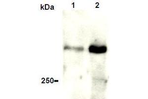 Western Blotting (WB) image for anti-Ataxia Telangiectasia Mutated (ATM) antibody (ABIN1449283)