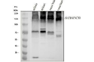 Western blot analysis of NCX1 using anti-NCX1 antibody (ABIN7605670).