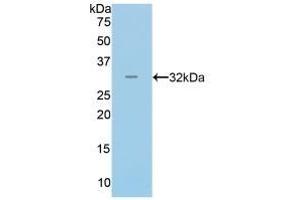 Detection of Recombinant MYH14, Human using Polyclonal Antibody to Myosin Heavy Chain 14, Non Muscle (MYH14) (Myosin anticorps  (AA 1069-1331))