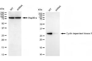 Western blotting analysis using cyclin dependent kinase 5 antibody (ABIN7798216).