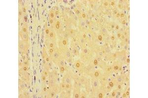Immunohistochemistry of paraffin-embedded human liver tissue using ABIN7154596 at dilution of 1:100 (RIT1 anticorps  (AA 1-219))
