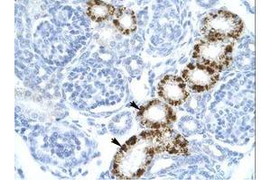 Image no. 1 for anti-Eukaryotic Translation Initiation Factor 2-alpha Kinase 2 (EIF2AK2) (C-Term) antibody (ABIN6735902) (EIF2AK2 anticorps  (C-Term))