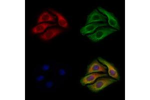 ABIN6255087 and ABIN6267322 staining Hela cells(4h of LPS treatment) by IF/ICC. (EIF4E anticorps  (pSer209))