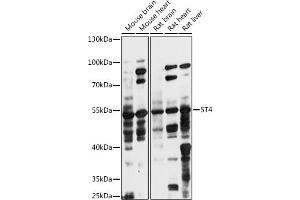 Western blot analysis of extracts of various cell lines, using 5T4 antibody (ABIN7271010) at 1:1000 dilution.