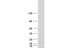 Validation with Western Blot