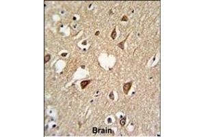 Formalin-fixed and paraffin-embedded human brain tissue reacted with SUMO1 Antibody, which was peroxidase-conjugated to the secondary antibody, followed by DAB staining. (SUMO1 anticorps)