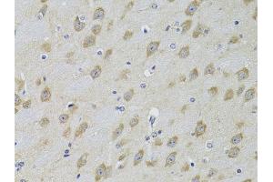 Immunohistochemistry of paraffin-embedded mouse brain using ADRBK2 Antibody (ABIN5971081) at dilution of 1/100 (40x lens). (ADRBK2 anticorps)