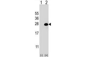 Western blot analysis of DGCR6L (arrow) using rabbit polyclonal DGCR6L Antibody (Center) .