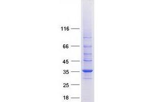 Validation with Western Blot