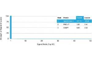 Analysis of Protein Array containing more than 19,000 full-length human proteins using Spectrin beta III Mouse Monoclonal Antibody (SPTBN2/1778).