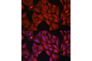 anti-Vasodilator-Stimulated phosphoprotein (VASP) (AA 1-100) antibody