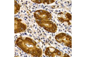Immunohistochemistry of paraffin-embedded human stomach using TFF1 antibody. (TFF1 anticorps)
