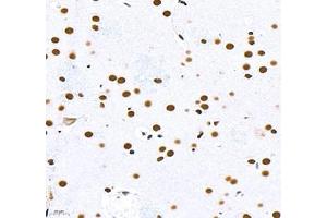 Immunohistochemistry of paraffin embedded rat brain using Top2 (ABIN7075937) at dilution of 1:600 (400x lens)