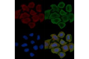 ABIN6262577 and ABIN6279542 staining Hela cells(30 min of UV treatment) by IF/ICC. (IMMP2L anticorps  (Internal Region))