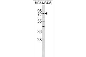 RFX3 Antibody (C-term) (ABIN656557 and ABIN2845819) western blot analysis in MDA-M cell line lysates (35 μg/lane). (RFX3 anticorps  (C-Term))