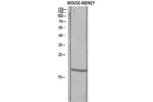 Western Blot (WB) analysis of Mouse Kidney lysis using TGFA antibody. (TGFA anticorps)