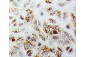 ICC testing of SMAD1 antibody and A549 cells (SMAD1 anticorps  (C-Term))