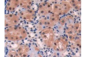 Detection of DRD1 in Human Kidney Tissue using Polyclonal Antibody to Dopamine Receptor D1 (DRD1)