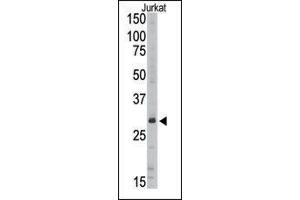 Image no. 1 for anti-Sirtuin 5 (SIRT5) (C-Term) antibody (ABIN358734)