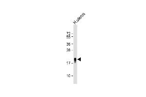 Anti-TAGLN Antibody (N-term) at 1:8000 dilution + H. (Transgelin anticorps  (N-Term))
