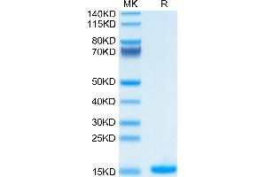 IL-2 Protein (AA 21-153)