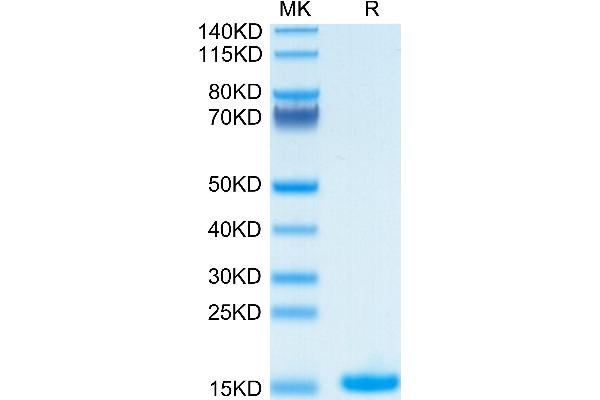 IL-2 Protein (AA 21-153)