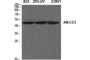 Western Blot (WB) analysis of specific cells using JNK1/2/3 Polyclonal Antibody. (JNK anticorps  (Lys278))