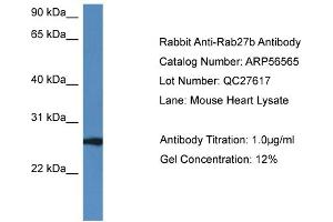 Western Blotting (WB) image for anti-RAB27B, Member RAS Oncogene Family (RAB27B) (C-Term) antibody (ABIN785819) (RAB27B anticorps  (C-Term))