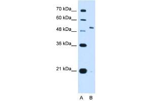 KCNC1 antibody used at 2. (KCNC1 anticorps  (N-Term))