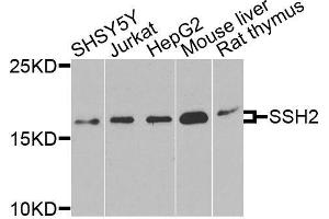 Western blot analysis of extracts of various cell lines, using SSH2 antibody (ABIN6003697) at 1/1000 dilution. (SSH2 anticorps)