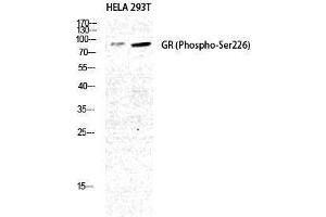 Western Blotting (WB) image for anti-GR (pSer226) antibody (ABIN3182520) (GR (pSer226) anticorps)