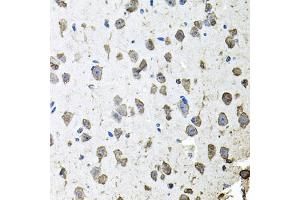 Immunohistochemistry of paraffin-embedded mouse brain using FGF1 antibody (ABIN5970259) at dilution of 1/100 (40x lens). (FGF1 anticorps)