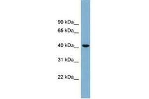 Image no. 1 for anti-UDP-Gal:betaGlcNAc beta 1,4- Galactosyltransferase, Polypeptide 2 (B4GALT2) (AA 107-156) antibody (ABIN6743309)