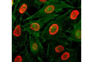 ICC/IF testing of HeLa cells treated with sodium butyrate using recombinant H3K9ac antibody (red).